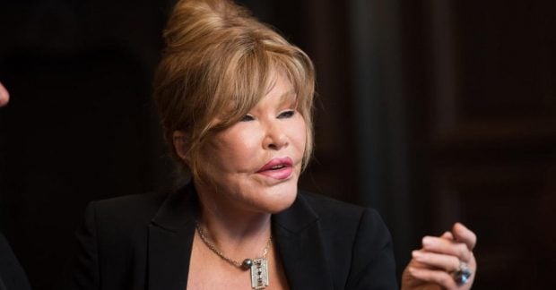 Скончалась Джоселин Вильденштайн, известная благодаря 80 пластическим операциям, за всю жизнь ставшая «женщиной-котом»